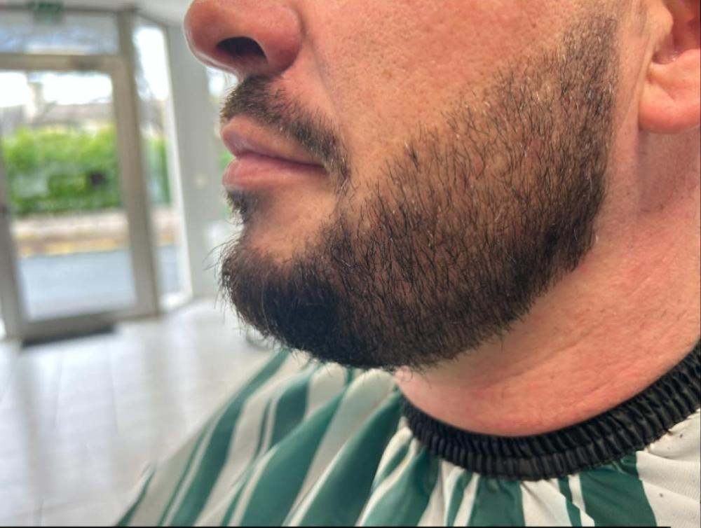 Taille de barbe